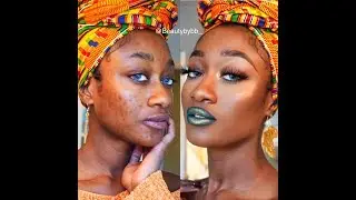 Full Acne Scar Coverage NO FOUNDATION NEEDED !! | Beautybybb_
