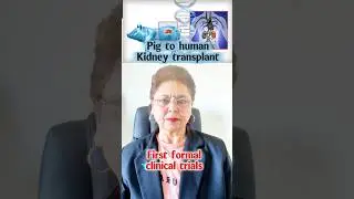 #foryou #news #newzealand #america #medical #science #kidney #transplants #trials #world #health #fy