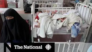Deadly attack on Afghanistan hospital damages hope for peace