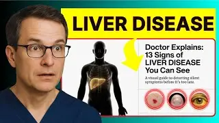 Over 60, 13 Signs of LIVER DISEASE You Can See (Doctor Explains)