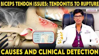 Biceps Tendon Problems:From Tendonitis to Rupture | Causes and Clinical Detection |Orthoderm Centre