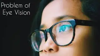 🦅Forever Eye 👁️ Vision Problem  & Solution Forever Product 👍