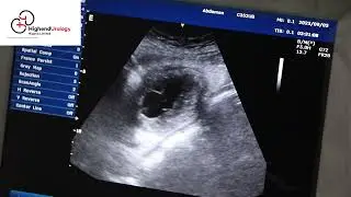 Ultrasound-guided Needle Puncture of Failed Urethral Catheter Balloon