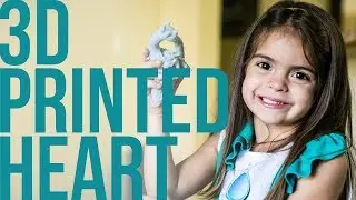 A 3D Printed Heart Saved Mia's Life-Threatening Heart Condition