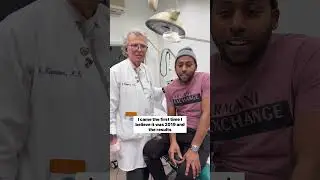 Acne Scar Treatment success story! #acnescars #acnescarremoval #acnescartreatment