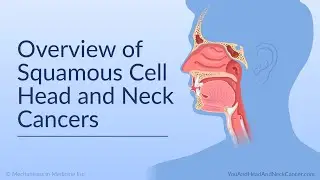 Overview of Squamous Cell Head and Neck Cancers
