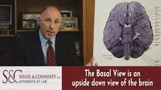 Brain Injury: How It Can Affect Your Senses -New York Medical Malpractice Attorney Andrew Siegel