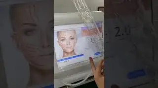 The most popular tech beauty right now | 9D HIFU MACHINE