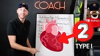 UNDERSTAND 2nd Degree Heart Block Type I