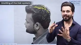 Fix Crown Area Hair Loss with a Customized Hair System