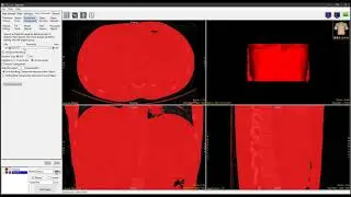 Analyze 14.0 - Segment: Connected Components