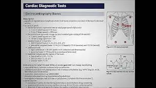 Electrocardiography Basics in 1 minute. #usmle #shorts #medical