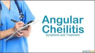 Angular Cheilitis &brvbar; Treatment and Symptoms  angular cheilitis treatment