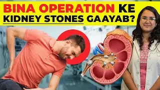 Bina Surgery Kidney Stones Se Mukti | Real Patient Proof Ke Saath | Effective Aur Safe Solution!