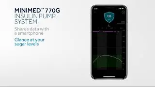 MiniMed 770G System &ndash; New Diabetes Management Technology