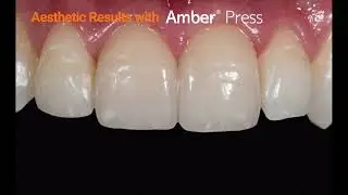 Amber Press