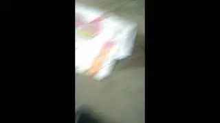 Creepy Headless Frog 🐸🤧 Jumps Krazyly😬😱