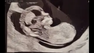 RASKAUSPÄIVÄKIRJA (Rv 4+0 -13+6) lasten reaktio vauva uutiseen🤭🤰🏼