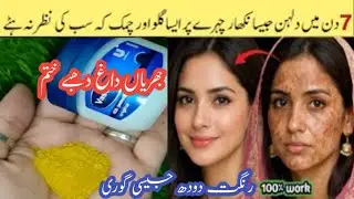 Besan face pack for brighten glowing skin | Best facepack for instant glow&nbsp;#facepackathome