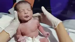 ENNS Baby Improvement | Start First Feeding Trial & NICU Care Observation#newborncare #babyrecovery 