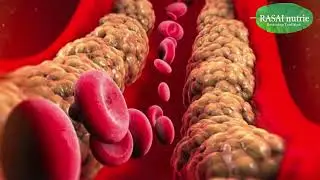 SHORT CHAIN FATTY ACID PART-2  CONVERSION OF TRIGLYCERIDES, PHOSPHOLIPIDS, CHOLESTEROL