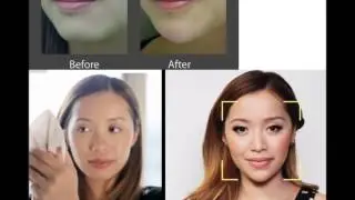 Michelle Phan plastic surgery? Proof