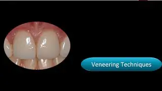 Continuing dental education - Catch the Composite Wave
