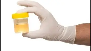 Drug Testing Welfare Recepients - Jamie Weinstein