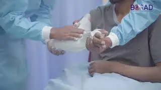 4  Long Arm posterior gutter