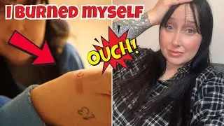 I Burned Myself OUCH  #ukvlogger #dailyvlog #dayinthelife
