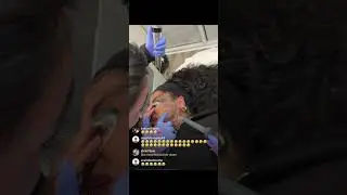 Chrisean Rock removes blueface face tattoo