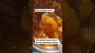 Best recipe for pregnancy anaemia #pregnancydiet #prenatalnutrition #garbhasanskar #amlamurabba