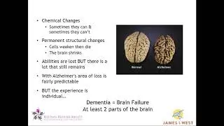 Caregiver Connection July Dementia Training