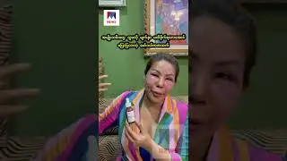 အမျိုးသမီးတွေ သူမလို မျက်နှာ မထိခိုက်ရလေအောင် ပြောပြလာတဲ့ မော်ဒယ်ဇာဇာထက်
