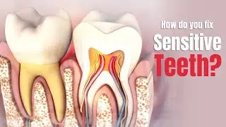 How do you fix sensitive teeth? Causes, Treatment Options, and Prevention Tips - 3D Guide