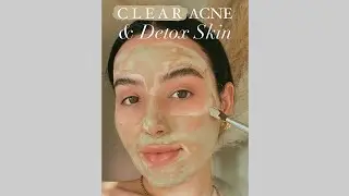 ОБЯЗАТЕЛЬНО ПОПРОБУЙТЕ МАСКУ ОТ АКНЕ И ДЕТОКС! 🤌🏽
