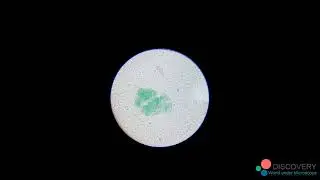 Toothpaste under Microscope 1000x | Ph&oacute;ng đại kem đ&aacute;nh răng 1000 lần