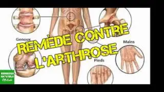 😲REM&Egrave;DE DE GRAND-M&Egrave;RE CONTRE L'ARTHROSE ★★★★★