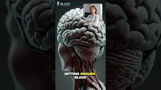 Part 2 &ldquo;Sudden Confusion Explained: Early Stroke Warning Sign You Must Know&rdquo; #StrokeWarning #shorts
