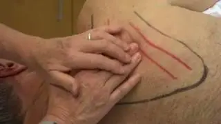 Dry Needling Tip Clip - Palpating and Grips