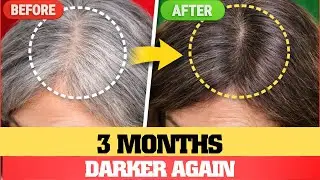After 3 months, New Hair Growth Looked Darker - Here&rsquo;s What She Did