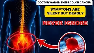 9 Hidden Colon Cancer Symptoms You Should Never Ignore | Doctor Explains