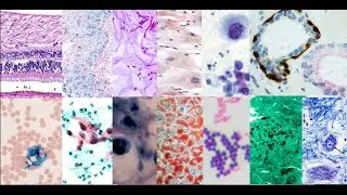 Different kinds of histology stains