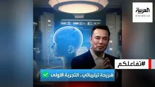 تفاعلكم | فعلها ماسك.. ونجح في زراعة شريحة في دماغ إنسان