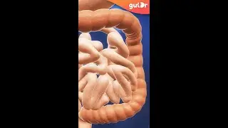 Что вызывает вздутие живота? | Объяснено в 3D #Shorts