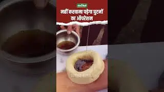 Ayurvedic treatment for knee problems | janu basti for knee pain | Panchkarma | Acharya Manish ji