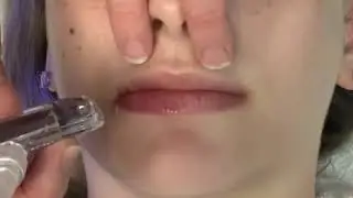 HydraFacial Lip Perk