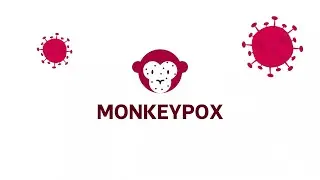 Learn more about monkeypox: What is it, how is it treated, and who is at most risk?