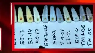 Dental ceramic custom color guides.