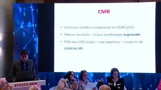 STCCV-2025-PVCs in athletes : detrain or stop ?-A  Mahdhaoui